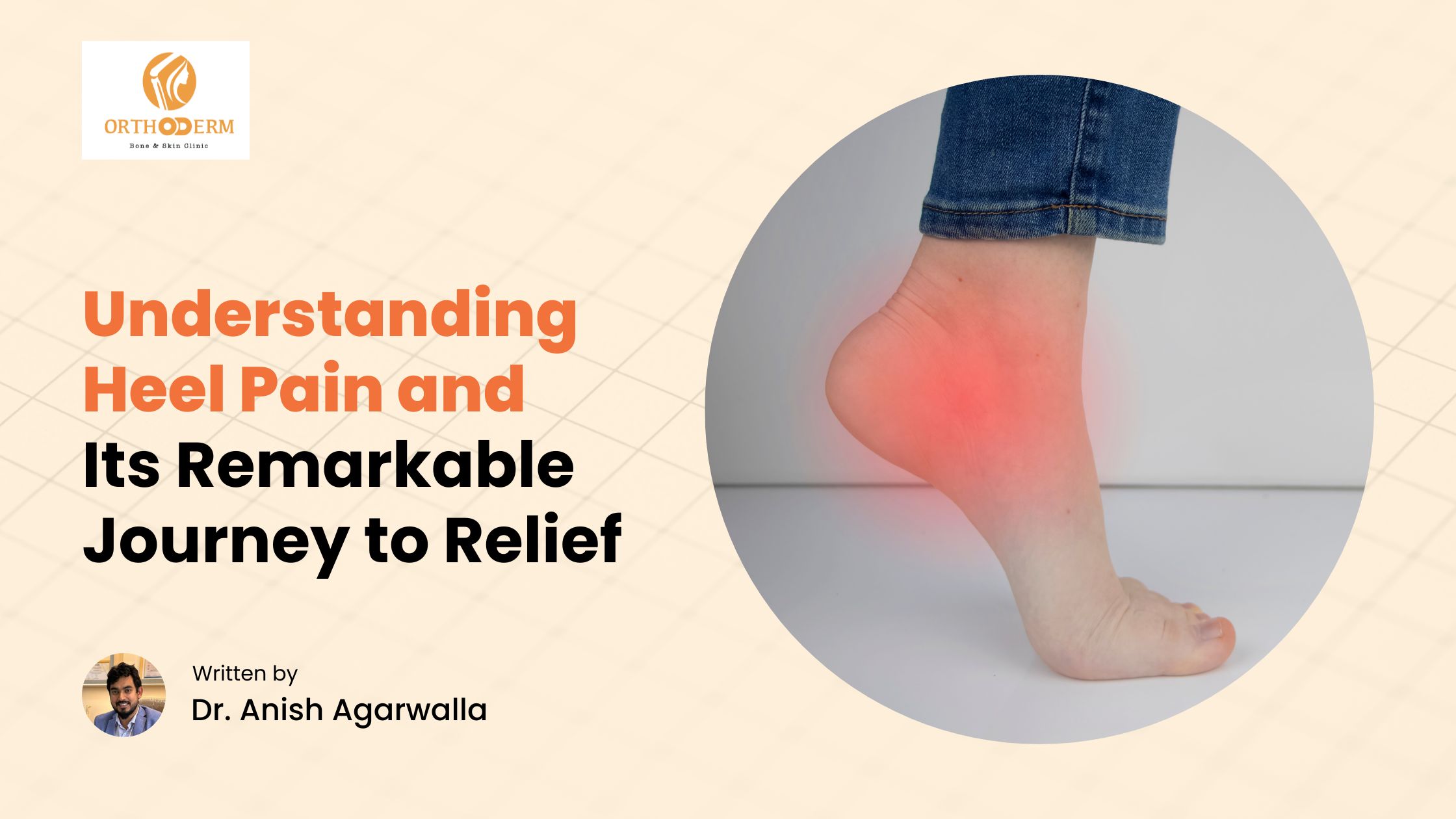 Will heel pain go away?