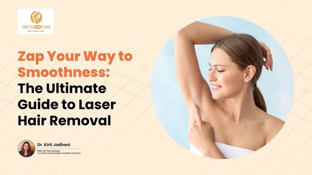 Laser Hair Removal: The Ultimate Guide to Smooth Skin