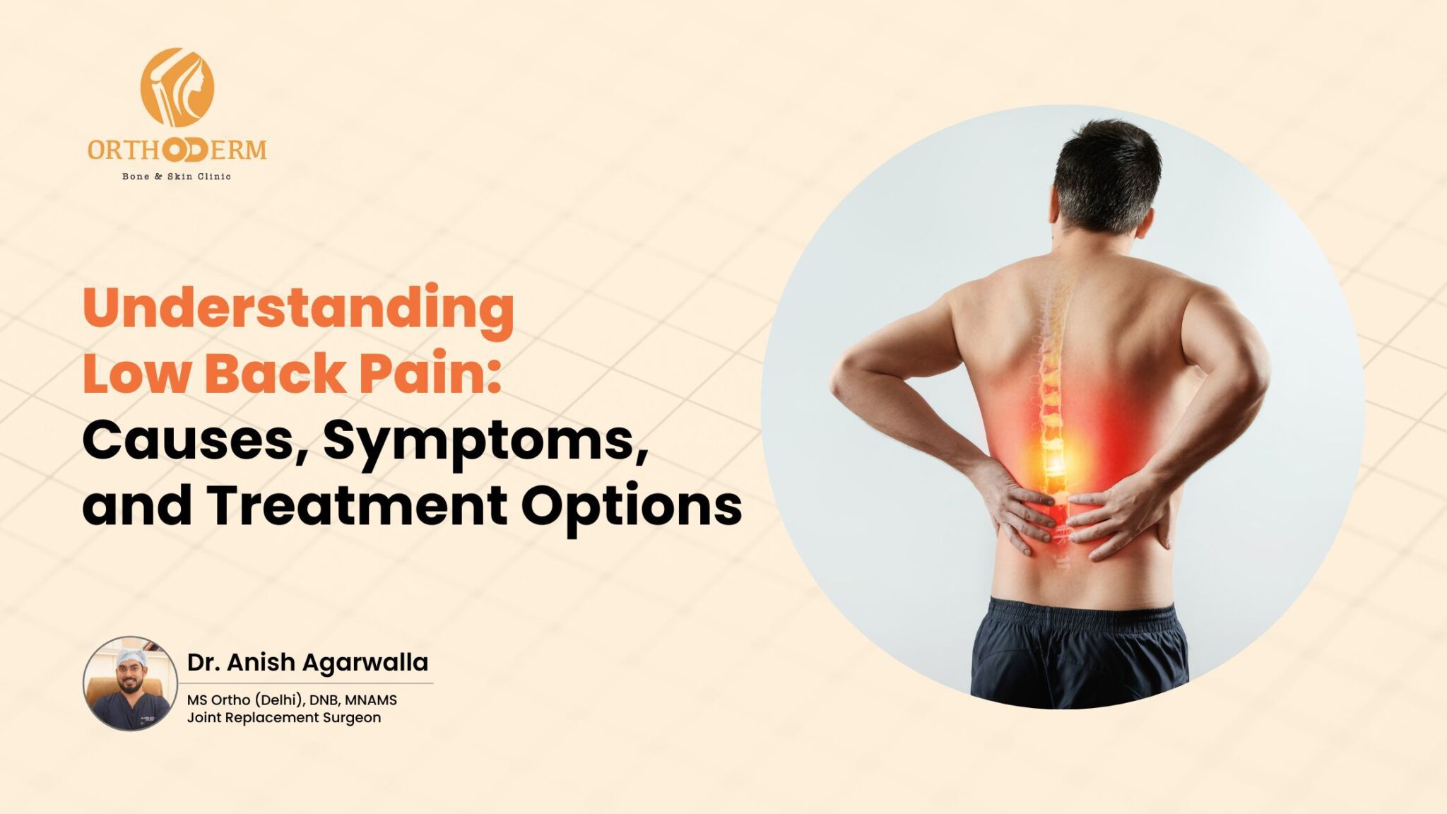 understanding-low-back-pain-causes-symptoms-and-treatment-options